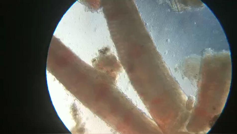 湖南黃顙魚鏡檢發(fā)現(xiàn)大量斜管蟲.png 湖南黃顙魚鏡檢發(fā)現(xiàn)大量斜管蟲.png